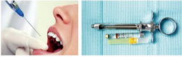 胰島素，牙科麻醉6.png